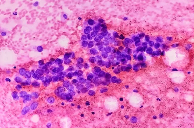 Cytopathology-1