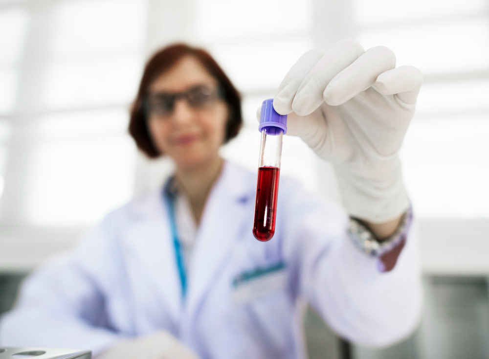 Reticulocyte Count: Key Test for Assessing Bone Marrow Function
