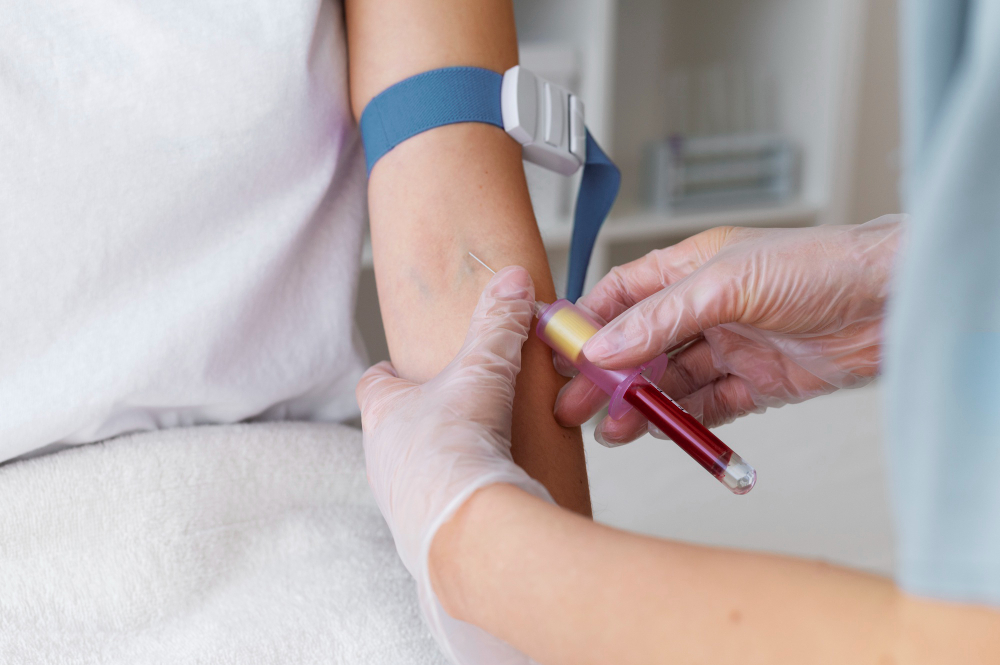 Rheumatoid Factor Test: Purpose, Procedure, and What Results Mean